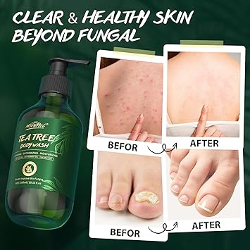 POP MODERN.C Tea Tree Body Wash Tea Tree Shower Gel with Peppermint Oil and Coconut Oil Improve Skin Fungus Skin Itchy Jock Itch Athletes Foot Eczema Body Odor Shower Gel with Pump for Men Women 300ml - Image 5