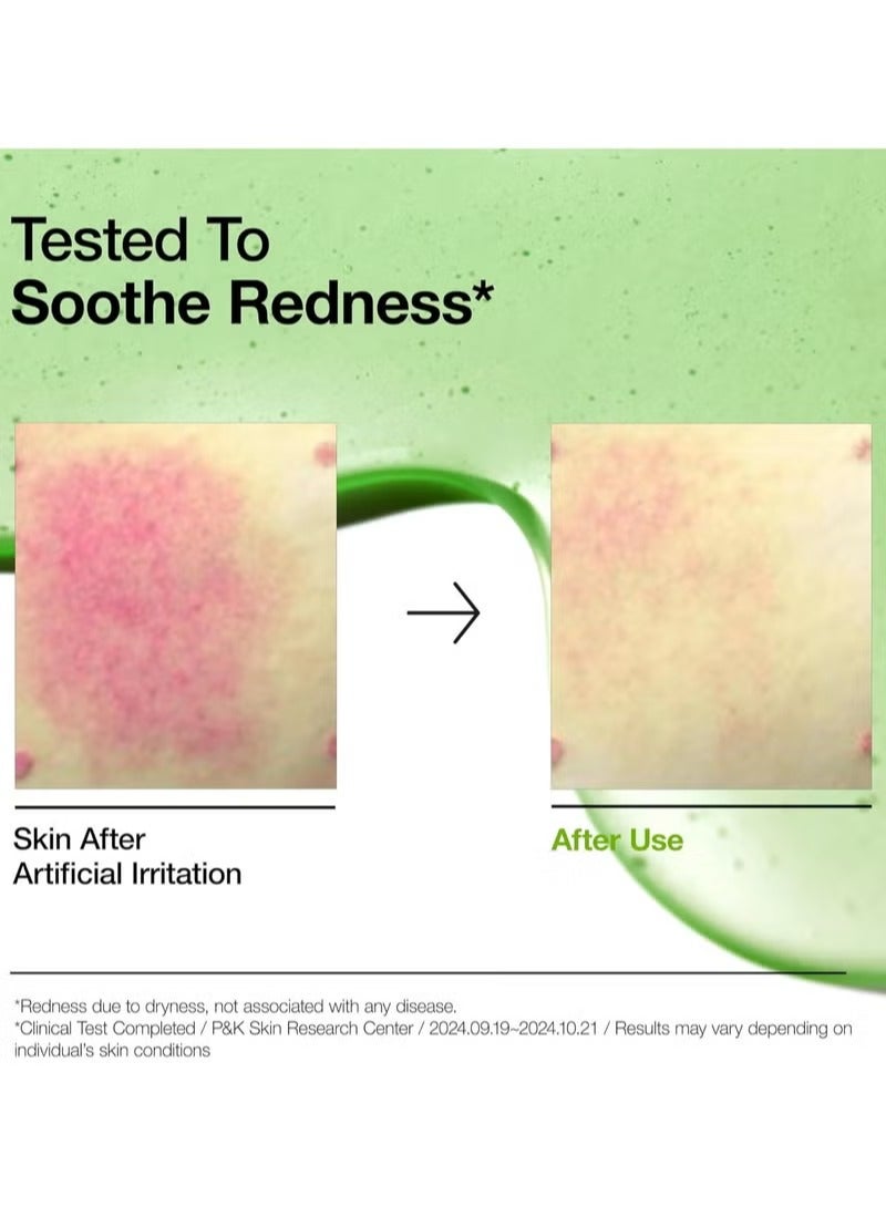 Anua Wonder Azelaic Acid 10 Hyaluron Redness Soothing Serum 30ml - Image 4