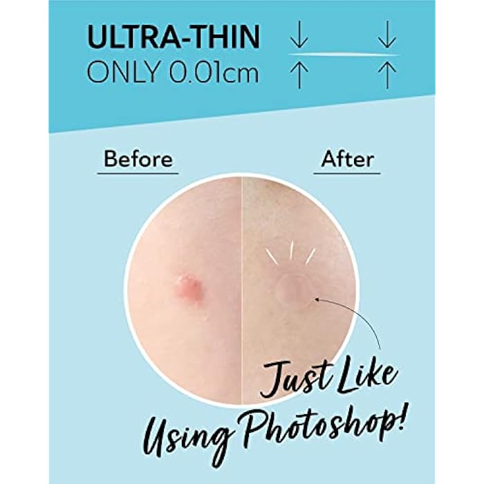 DERMA ANGEL Invisible Salicylic Acid Pimple Patches for Face - Redness Reducing Hydrocolloid Acne Patches, Clear Pimple & Zit Patches for Blind Pimples - 36 Count 2 Sizes Soothing Plus (Clear Patch) - Image 4