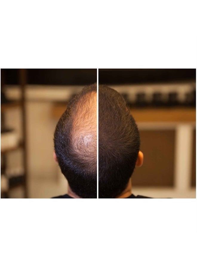 FIXDEEP Hair Thickener | New Waterproof Formula - Natural & Fuller Looking Hair in 30 sec - 14g - Hair Fibers for Thinning Hair & Bald Spots & Graying Hair Roots (Dark Brown) - Image 2