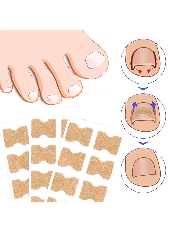 سيفودون رقعة مصحح أظافر نام ، شرائط مصحح أظافر نام 100 قطعة ، بقع تصحيح أظافر القدم ، أداة علاج أظافر نام العناية بالقدم ، ملصقات تصحيح أظافر القدم بدون غراء - Image 5