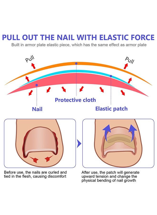 سيفودون رقعة مصحح أظافر نام ، شرائط مصحح أظافر نام 100 قطعة ، بقع تصحيح أظافر القدم ، أداة علاج أظافر نام العناية بالقدم ، ملصقات تصحيح أظافر القدم بدون غراء - Image 3