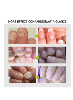efero Efero Nail Treatment Repair Gel 20g  - Image 5