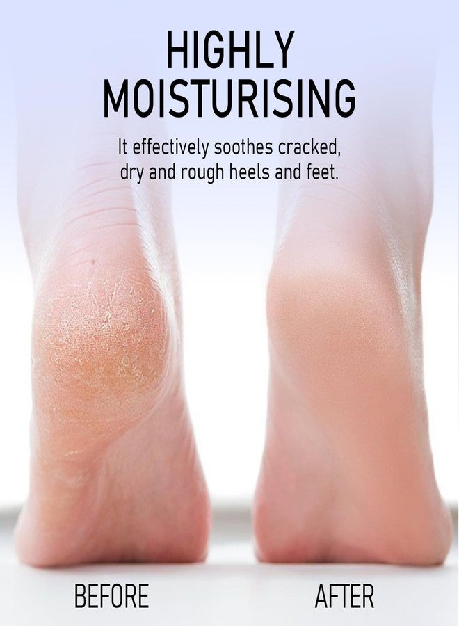 FREEORR 2Pcs Crack Feet Prevention Stick, Moisturizing and Hydrating Foot and Hand Balm, Remove Dead Skin Softening and Nourishing Anti-Cracking Foot Cream for Feet Elbows Knees - Image 5