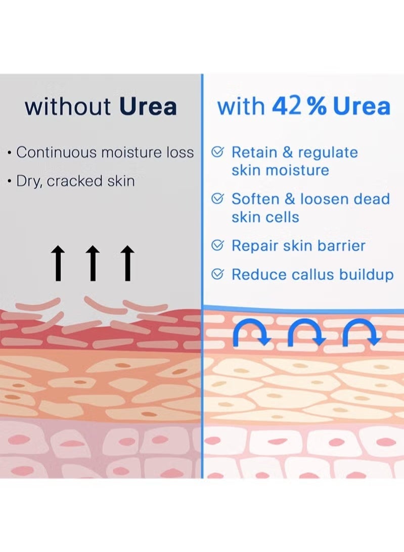 ISSUWEN Urea Repair Cream – Deep Moisturizing for Dry, Cracked Heels, Knees, Elbows, and Hands - Image 4