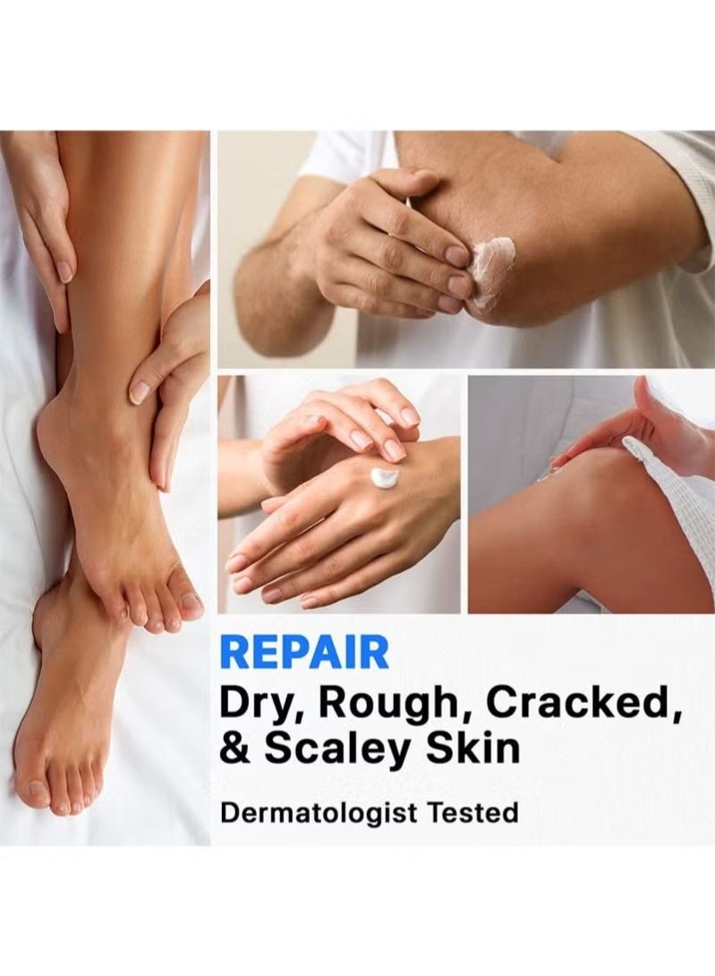 ISSUWEN Urea Repair Cream – Deep Moisturizing for Dry, Cracked Heels, Knees, Elbows, and Hands - Image 5