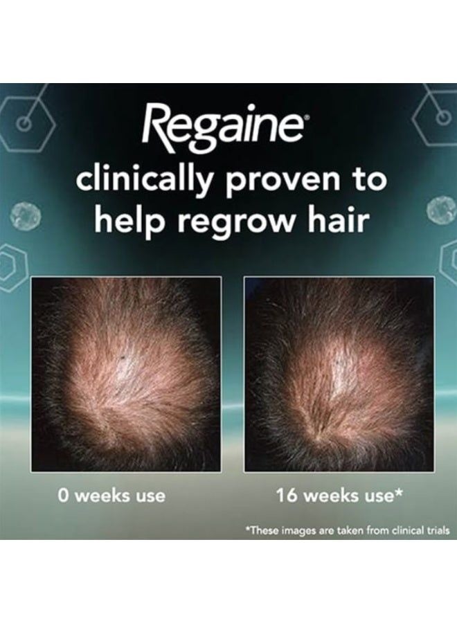 Regaine For Men Extra Strength 5% Minoxidil Hair Regrowth Foam 73ml × 3 Pack, Hair Loss Treatment for Men, Thinning Hair, Hair Regrowth & Male Pattern Hair Loss - Image 5