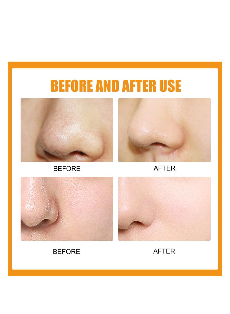 إيلهو إزالة حب الشباب من الأنف ، وتنظيف وتقليص المسام مع عصا الأنف - Image 3