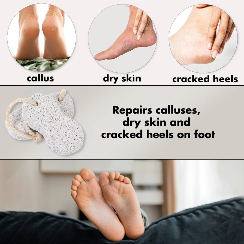 Jairestone Pumice Stone for Feet - Natural Earth Lava Pumice Stone for Foot Callus - Foot Scrubbers for Use in Shower - Pack of 2 - Image 2