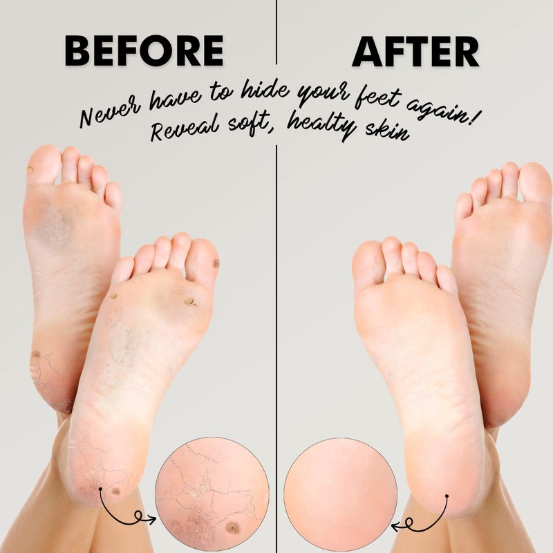 Jairestone Pumice Stone for Feet - Natural Earth Lava Pumice Stone for Foot Callus - Foot Scrubbers for Use in Shower - Pack of 2 - Image 4