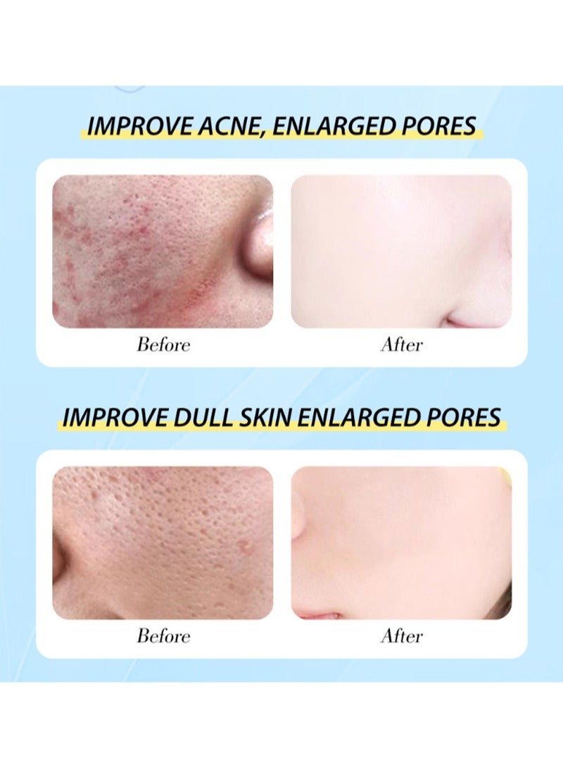 MOOYAM Salicylic Acid Facial Set,2% Salicylic Acid Cleanser 80g+Facial Serum 30ml with Salicylic Acid 2%+Acne Cream 20g with 2% Salicylic Acid,Deep Moisture and Oil Control,Pore Cleaning,Soothing For Acne-Prone Skin,Unisex,Hypoallergenic,Ideal For All Skin Types - Image 2