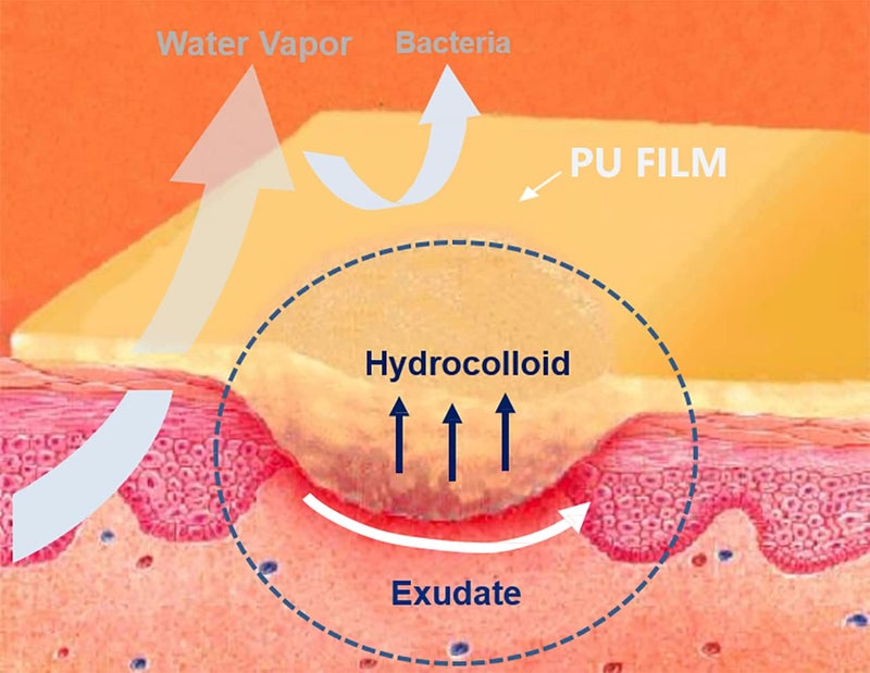 Dimora Hydrocolloid Adhesive Bandage Hydrocolloid Wound Dressing Thin Type 4 x 4 Individually Sterile Packed Hydrocolloid Patches Box of 10 Dressings - Image 4