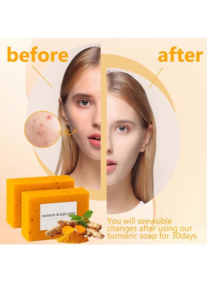 guluxly Lemon Turmeric Kojic Soap, Turmeric Soap for Spots Remover with Vitamin C, Lemon, Retinol Collagen, Shea Butter More Moisturizing for Face and Body (4) - Image 2