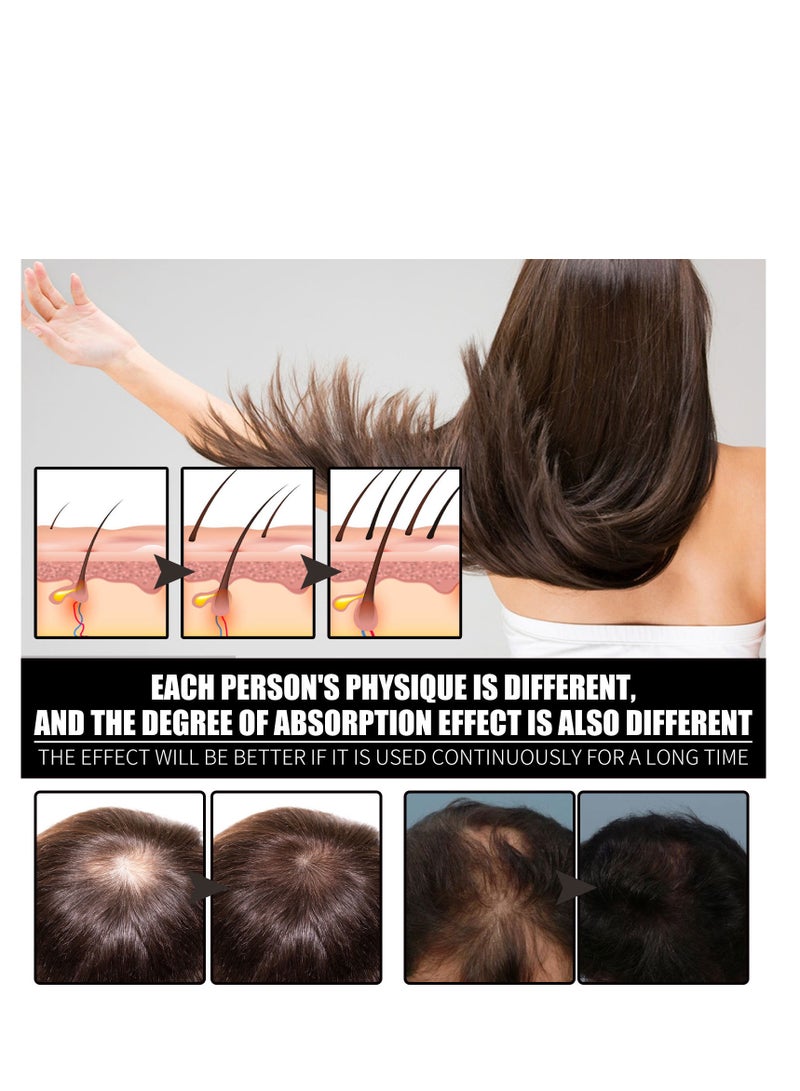 Biotin With Hydrolyzed Collagen B7 Vitamin Super Absorption,Fast Hair Growth & Hair Loss Prevention Essential Oil 30ml