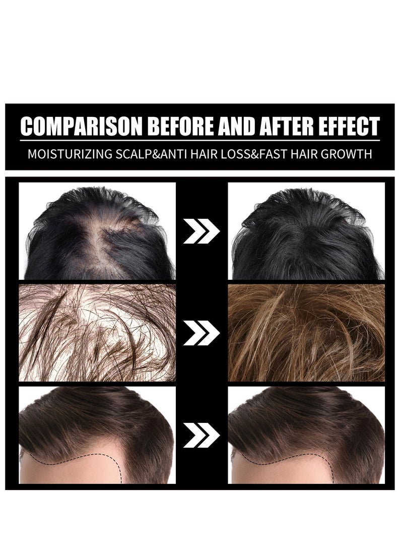 Biotin With Hydrolyzed Collagen B7 Vitamin Super Absorption,Fast Hair Growth & Hair Loss Prevention Essential Oil 30ml