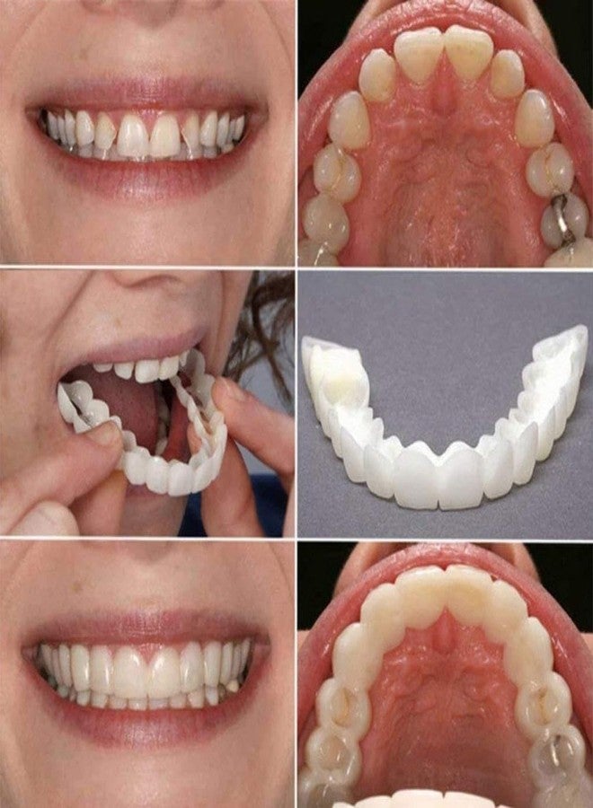 Wrishay قشور أسنان Wrishay Snap-On Instant Perfect Smile، أطقم أسنان مرنة ومريحة للأسنان العلوية والسفلية، غطاء تجميلي للأسنان البيضاء (1) - Image 4