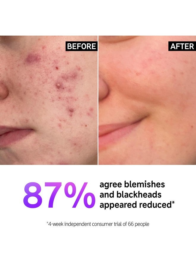 The INKEY List Salicylic Acid Cleanser, Face Wash for Blemishes, Blackheads, Oily Skin and Breakouts, Non-Drying Facial Cleanser Safe for All Skin Types, 5.0 fl oz - Image 2