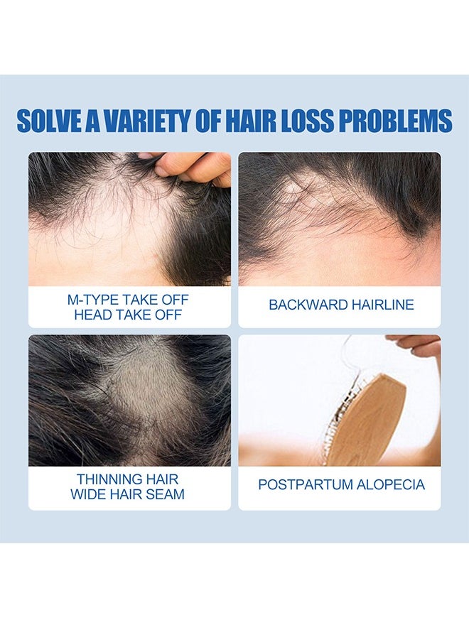 East Moon - Extra Strength For Men Minoxidil 5% ，for Promote Men's Hair and Beard Growth,Prevent Hair Loss,Care for Hair-60ml - Image 1