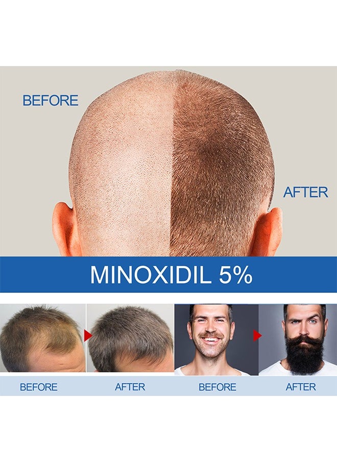 East Moon - Extra Strength For Men Minoxidil 5% ，for Promote Men's Hair and Beard Growth,Prevent Hair Loss,Care for Hair-60ml - Image 1