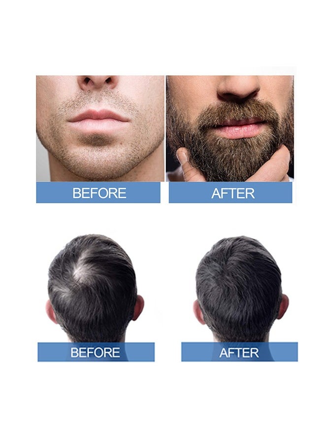 East Moon - Extra Strength For Men Minoxidil 5% ，for Promote Men's Hair and Beard Growth,Prevent Hair Loss,Care for Hair-60ml - Image 1