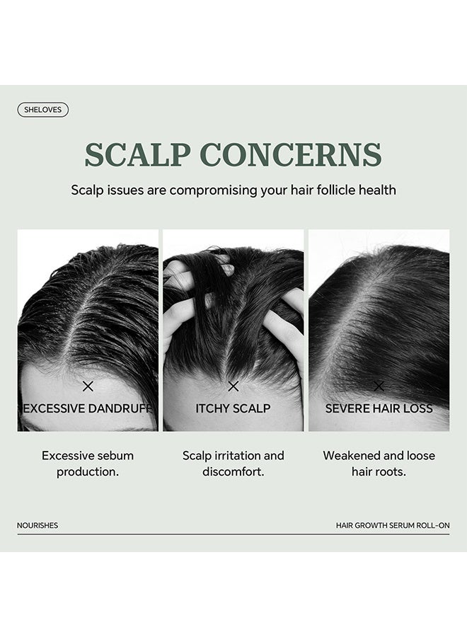 Sheloves Hair Growth Serum Roll-On,3% Rosemary, 3% Redensyl, 2% Anagain, 2% Aminexil, Serum for Hair Loss & Hair Regrowth For Men & Women - Image 3