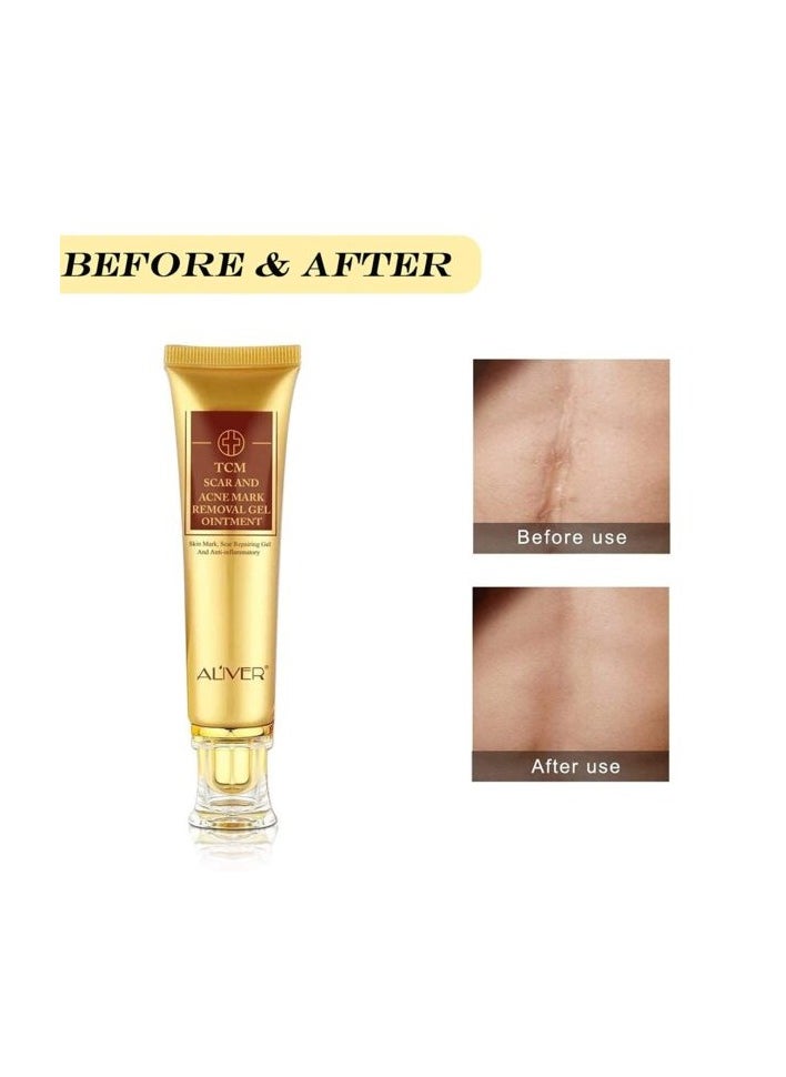 ALIVER - ALIVER TCM Scar And Acne Mark Removal Gel Ointment 30g - Image 1