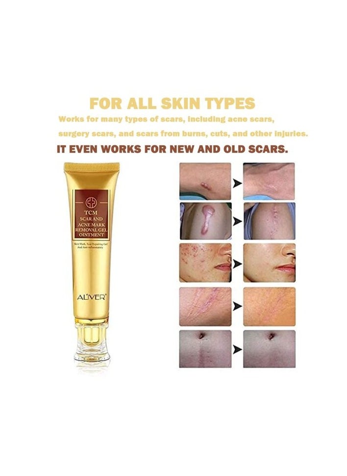 ALIVER - ALIVER TCM Scar And Acne Mark Removal Gel Ointment 30g - Image 1
