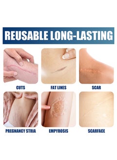 Jaysuing Silicone Scar Gel 30G, For Scar Removal, Scar Treatment, Scar Removal Cream For C-Section, Stretch Marks, Acne, Surgery, Effective For Both Old And New Scars  - Image 4