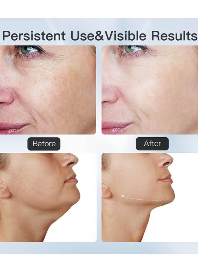 جهاز تدليك الوجه والرقبة – مدلك شد البشرة وإزالة التجاعيد – أداة نحت الوجه للعناية بالبشرة وتحسين الملمس والنعومة - Image 2