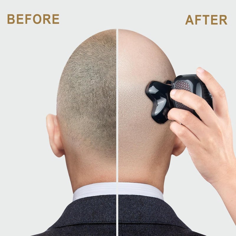 Telfun Upgrade Magnetic Head Shavers for Bald Men, Cordless & Comfort 5-in-1 Electric Razor - IPX7 Waterproof Wet/Dry Mens Grooming Kit - Easy Use Palm Shaver for a Smooth Bald Shave - Image 5