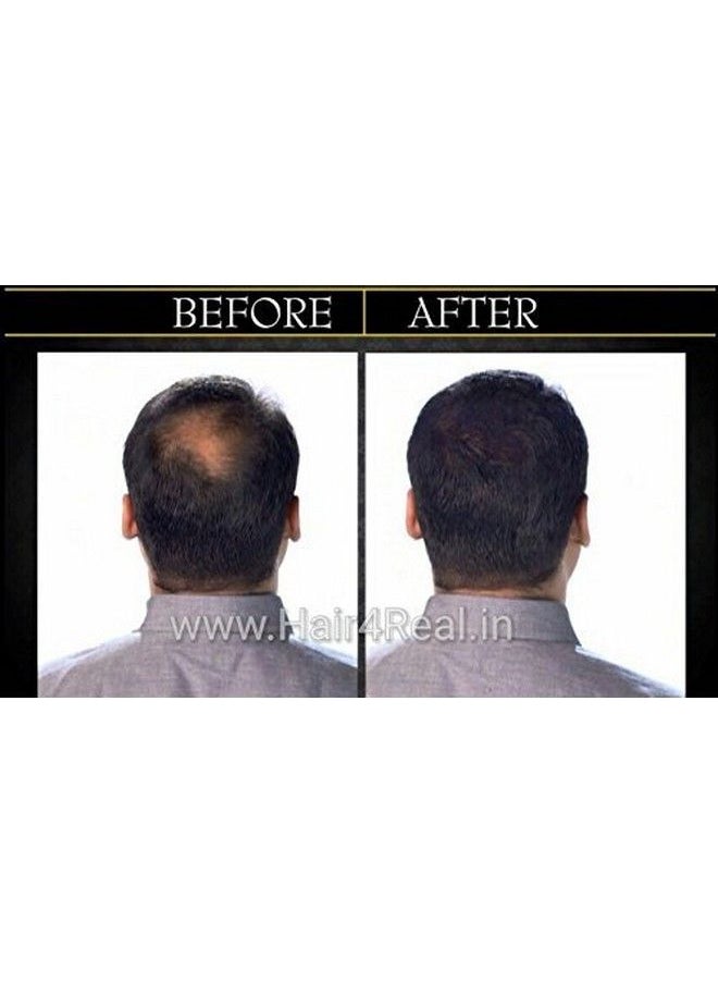 HAIR4REAL Hair Thickening Fiber Refill Black 25 G  - Image 5