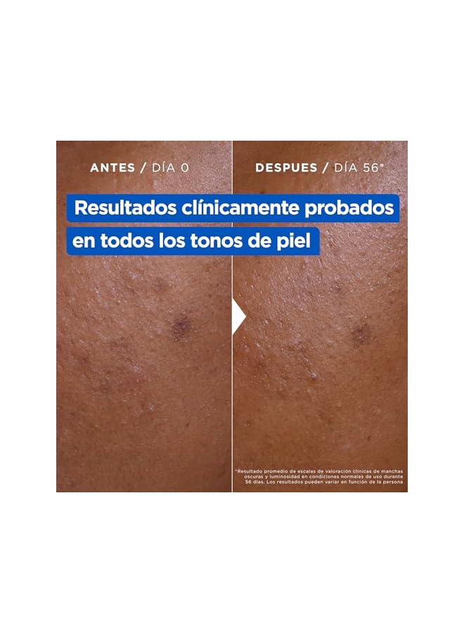 mixa Anti-Stain Moisturising Cream for Dry and Dull Skin, Moisturized Skin for 48H, Bright, Uniform Skin with 9% Niacinamide, Vitamin C and Shea Butter, Niacinamide Bright, 400ml - Image 5