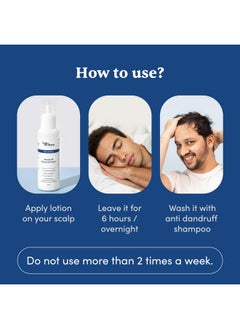 Man Matters Anti Dandruff Lotion For Men [60Ml] | Instant Itch Relief & Cooling With Menthol & Tea Tree Oil  - Image 3