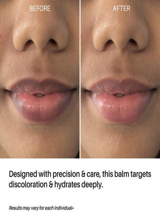 glutathione lip balm before and after results DermDoc Care Kuwait | Best Price Offers Oral vs. Intramuscular Vitamin secondary_rejuvenation Color:Vitamin