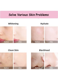 8 in 1 Hydro-Oxygen Machine, Facial Care Device, Multi-Functional Vacuum Suction Skin Cleansing Machine, Exfoliating, and Shrinking Pores, Rejuvenating Massager Small Bubble Device