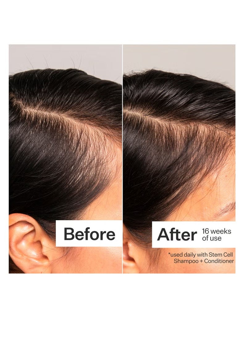 Act+Acre 3% Stem Cell Peptide H3-Grow+ Complex Scalp Treatment For Hair Thinning and Growth 89ml - Image 3