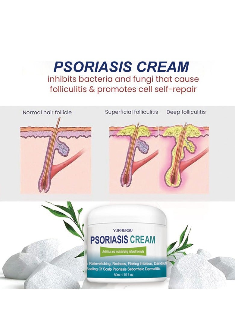 YURHERSU كريم الصدفية، علاج فروة الرأس للصدفية، كريم داء الثعلبة البشري، بلسم للقدم والجسم، مضاد للحكة يساعد في تخفيف الحكة، القشرة، التهاب الجلد الدهني، مرطب، مناسب للعناية اليومية بالبشرة 50 مل - Image 3