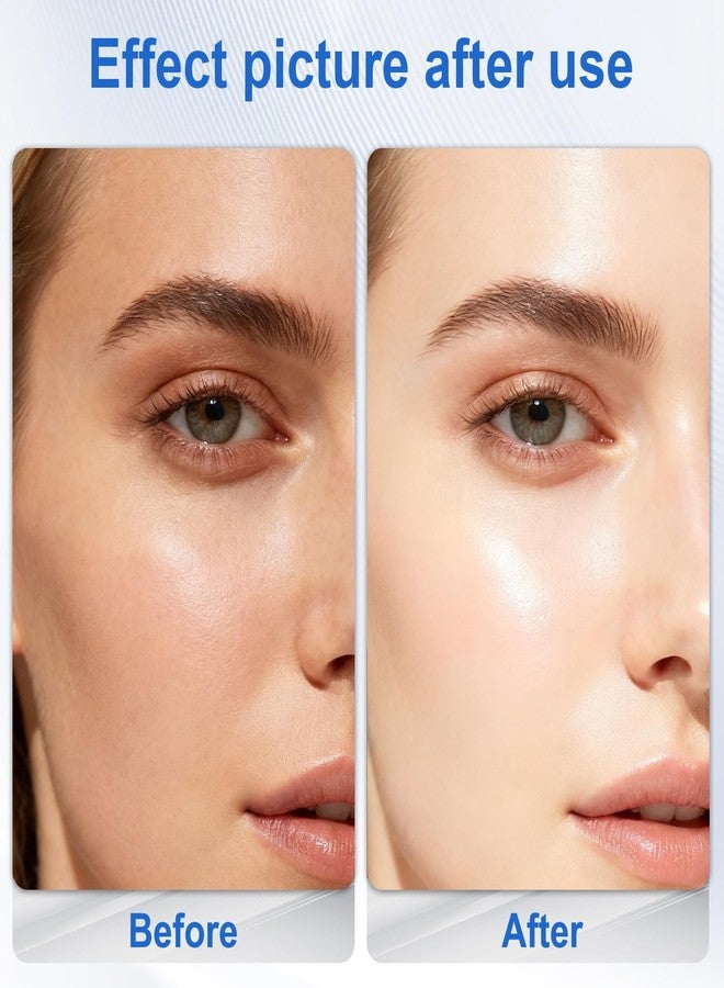 DERMFREE Milia Remover for Face & Eyelids, Salicylic Acid Treatment Serum - Image 4