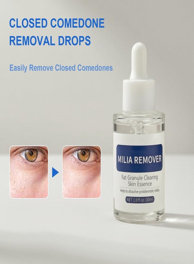 DERMFREE Milia Remover for Face & Eyelids, Salicylic Acid Treatment Serum - Image 2