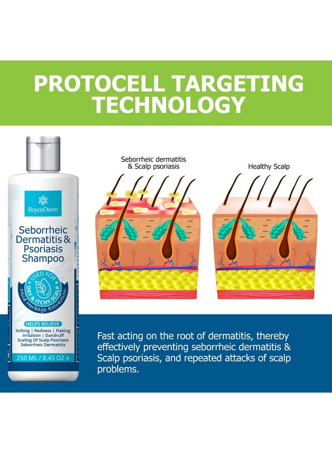 Roycederm Psoriasis Shampoo, Seborrheic Dermatitis Shampoo, Folliculitis Shampoo, Dandruff Shampoo, Scalp Psoriasis & Seborrheic Dermatitis Treatment, Dry Itchy Scalp Treatment