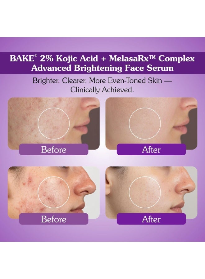BAKE 2% Kojic Acid Face Serum with MelasRx Complex, Alpha Arbutin & Niacinamide for Dark Spots, Pigmentation & Brightening Glow Skin| For Tan Removal & Sun Damaged Skin | Brightening Glow | 30ml - Image 4