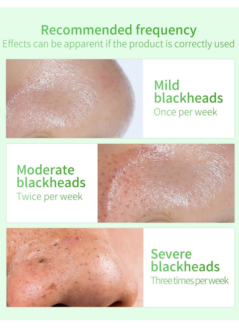 LANBENA - Blackhead Remover Mask, Blackhead Remover Mask Peel Off Blackhead Mask 2 in 1 Green Tea Oil Blackhead Removal 100 Pcs Blackhead Remover Mask for Pores, Nose, Chins & Face - Image 1