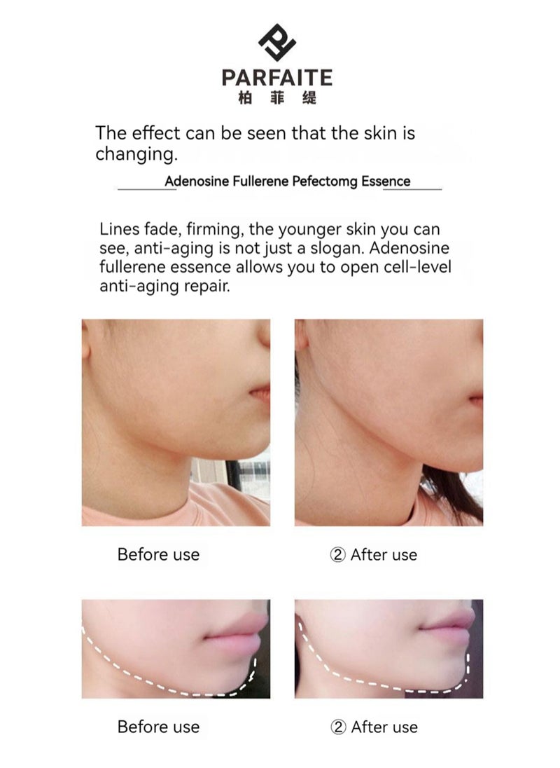PARFAITE - PARFAITE Adenosine Fullerene Firming Serum Ampoule Anti-Aging, Reduces Fine Lines, Firms Contours And Brightens Skin Tone,2ml*7 Pack Skincare Hyaluronic - Image 1