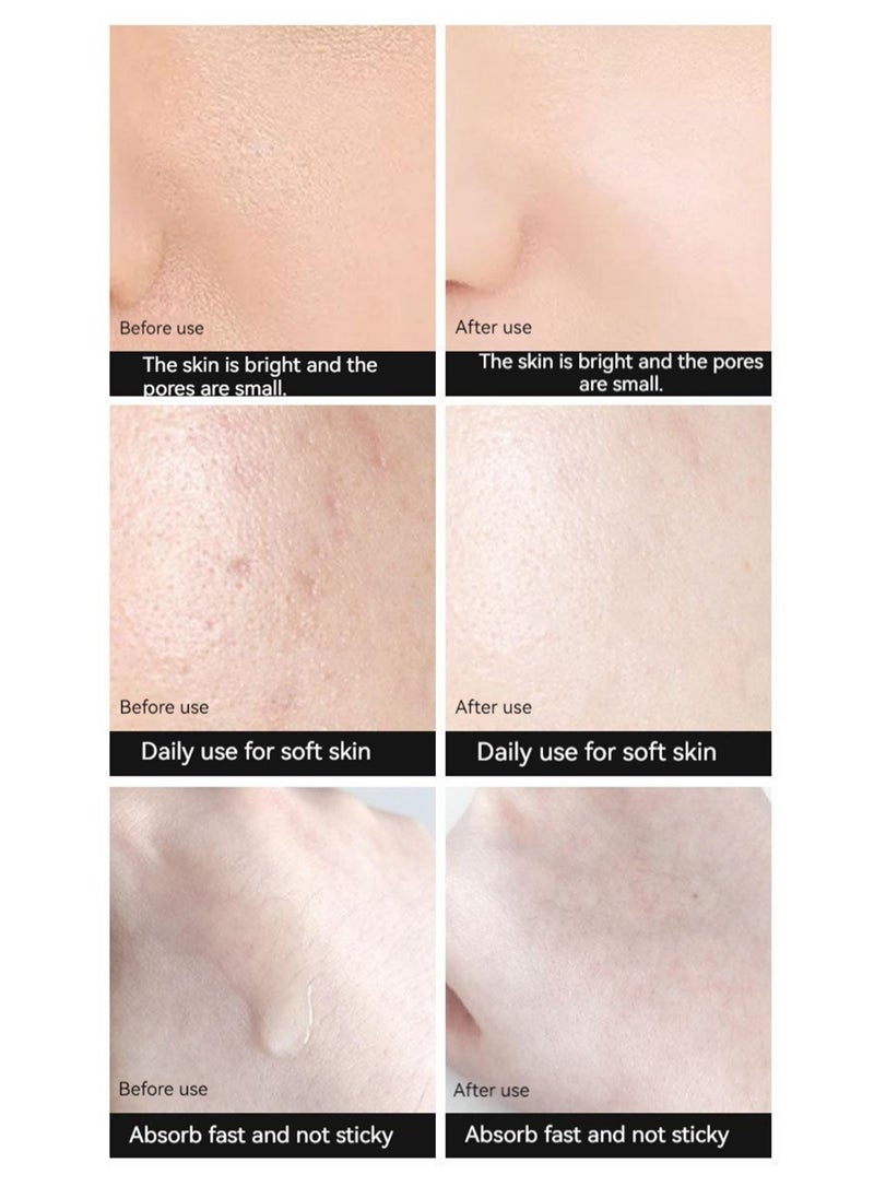PARFAITE - PARFAITE Adenosine Fullerene Firming Serum Ampoule Anti-Aging, Reduces Fine Lines, Firms Contours And Brightens Skin Tone,2ml*7 Pack Skincare Hyaluronic - Image 1