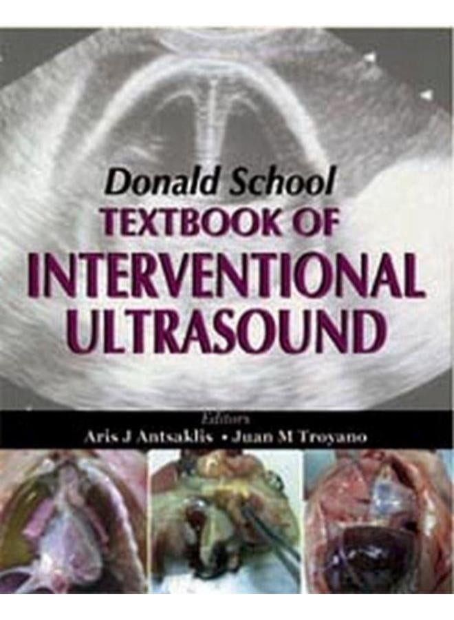 Donald School Textbook of Interventional Ultrasound
