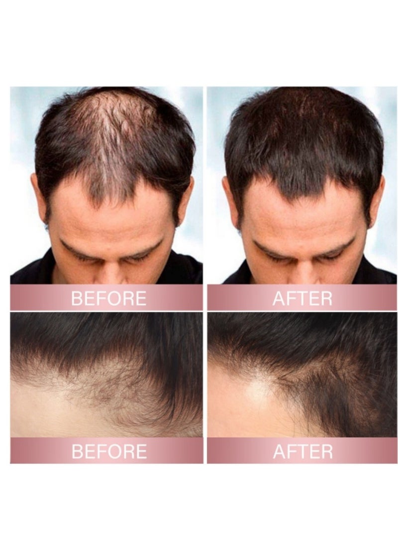 EELHOE - Rice Hair Thickness Spray Strengthens hair, repairs hair follicles and roots, prevents hair loss, solidifies hair, and thickens hair spray - Image 1