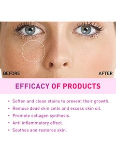 Jaysuing Milia Spot Treatment Helps to Dissolve and Reduce Problematic Remover with Natural Ingredients Gentle on Skin Safe - 30ml  - Image 4