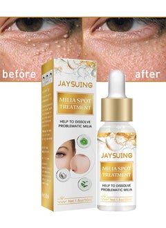 Jaysuing Milia Spot Treatment Helps to Dissolve and Reduce Problematic Remover with Natural Ingredients Gentle on Skin Safe - 30ml  - Image 1