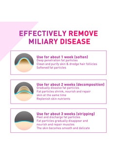 Jaysuing Milia Spot Treatment Helps to Dissolve and Reduce Problematic Remover with Natural Ingredients Gentle on Skin Safe - 30ml  - Image 5
