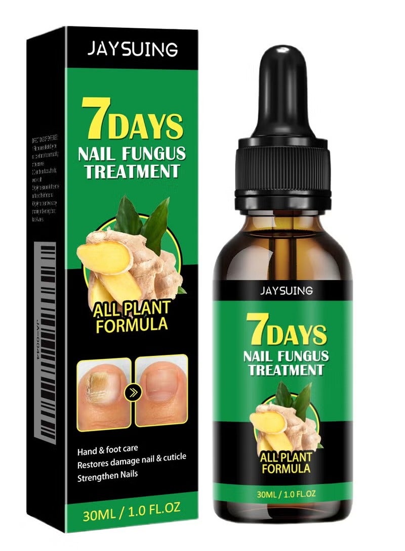 Jaysuing 7 DAYS Ginger Foot Spray, Nail Repair, Ginger Nail Treatment, Ginger Nail Treatment, Ginger Cuticle Care Oil for Nails Strengthener Oil (30ml) - 1PC ﻿ - Image 1